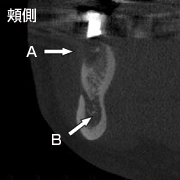 CTiConputed TomographyERs[^fwBej